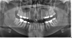 Dental Radiology with Prof. Donis Tatro