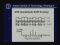 Transmission of Analog Signal (Part II)