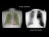 Airways, Bones, and Soft Tissues