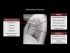Cardiac Silhouette and Mediastinum