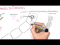 Diabetes Complication and Pathophysiology of the complication