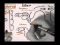 Bone Homeostasis (Calcium and Phosphorus) Part II