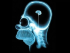 19. Biology & Traits: Openness/Intelligence/Creativity II