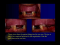 DENT 718: Combination cases: complete and partial denture sets