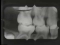 Pedodontic Radiographic Interpretation