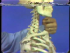 Radiographic Anatomy: The Shoulder Region