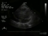 Cardiovascular: Echocardiogram