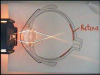Eye, Focus, Optical Lens